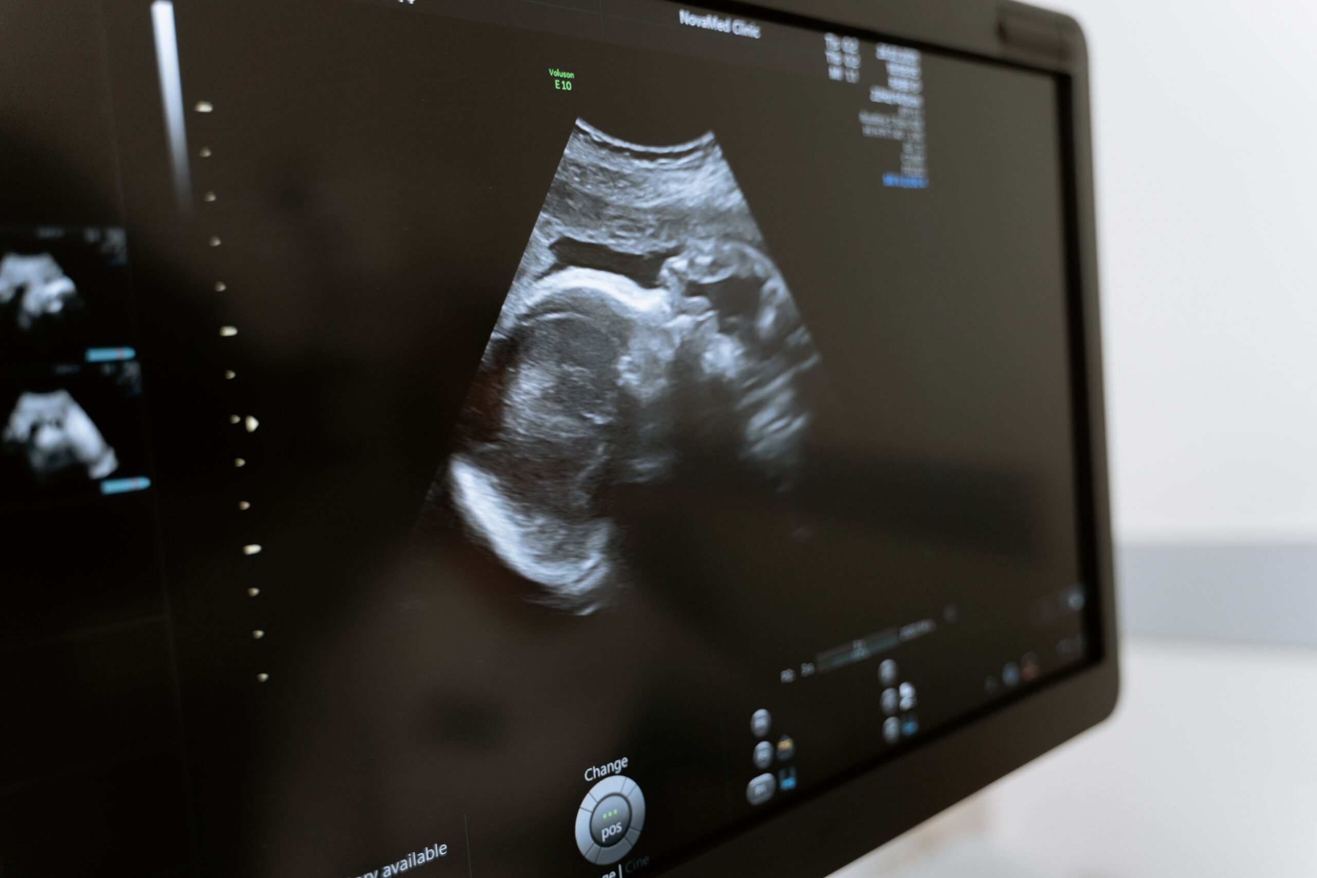 What does the God have to say about the abortion of unborn babies?